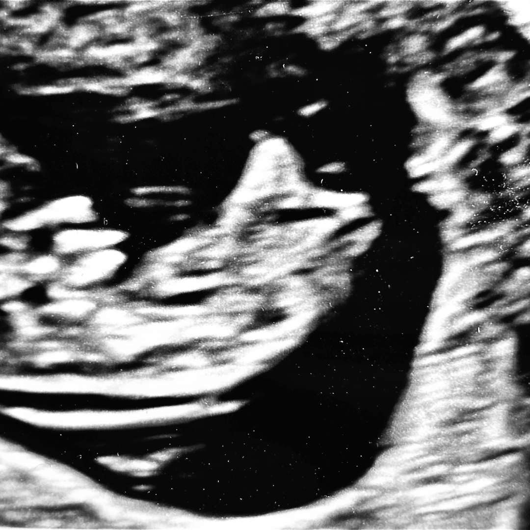 Photo shared by Katarina for their Babylist baby registry.