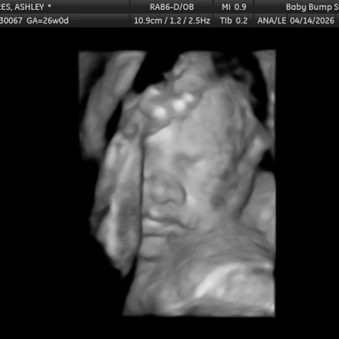 Photo shared by Ashley for their Babylist baby registry.