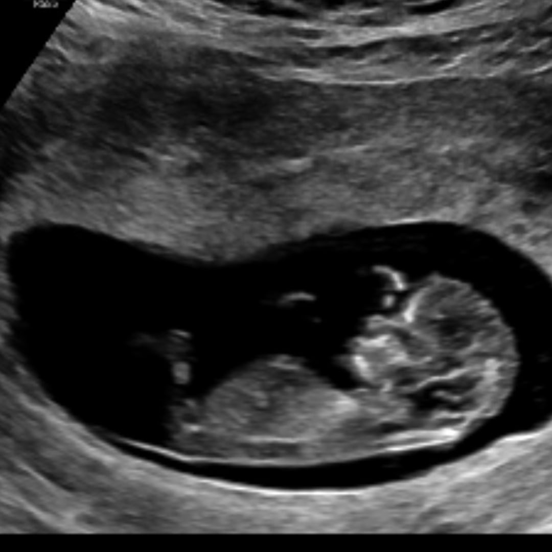 Photo shared by Brittany for their Babylist baby registry.