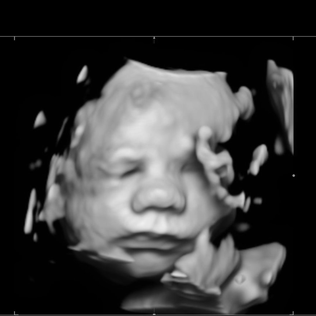 Photo shared by Keara for their Babylist baby registry.
