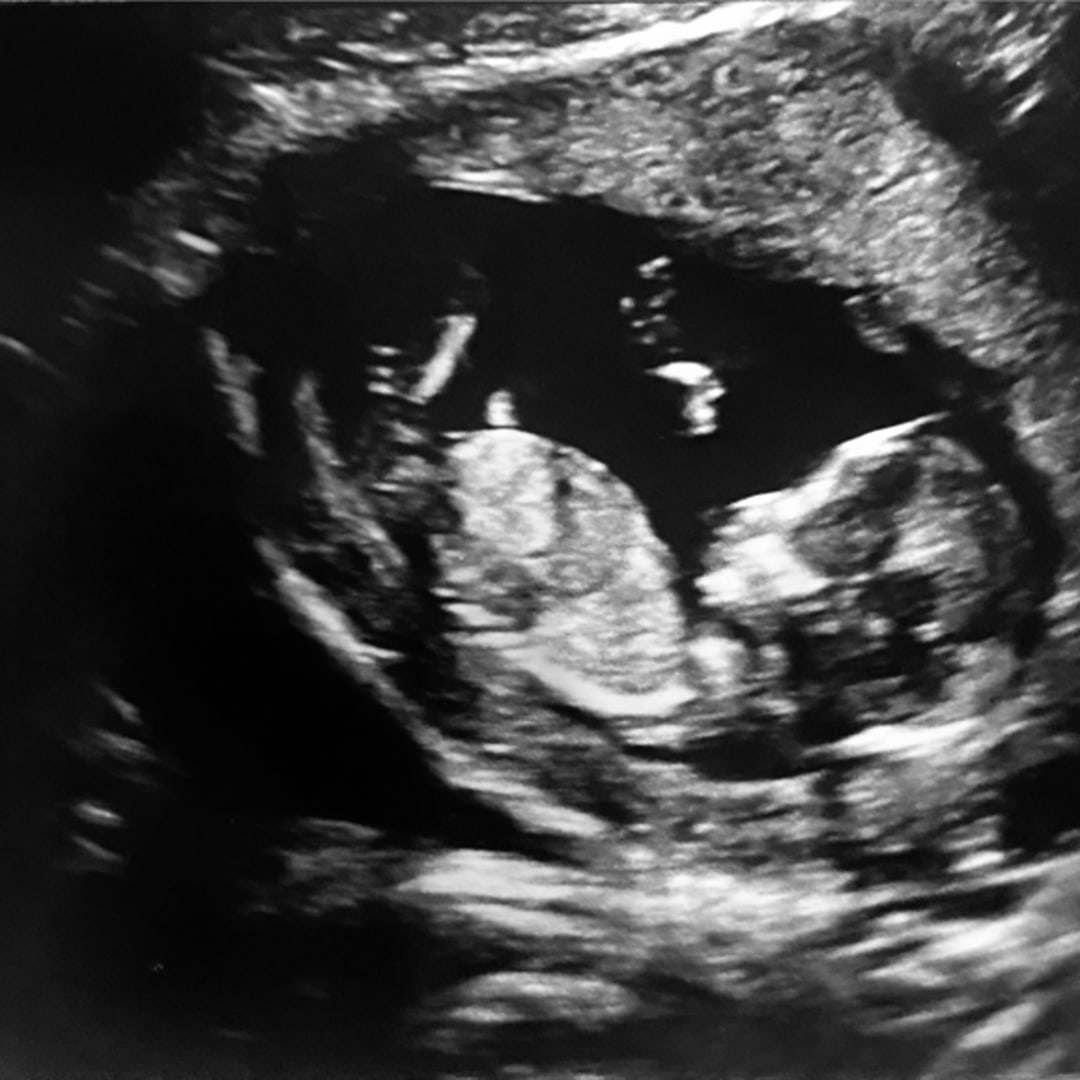 Photo shared by Madison for their Babylist baby registry.