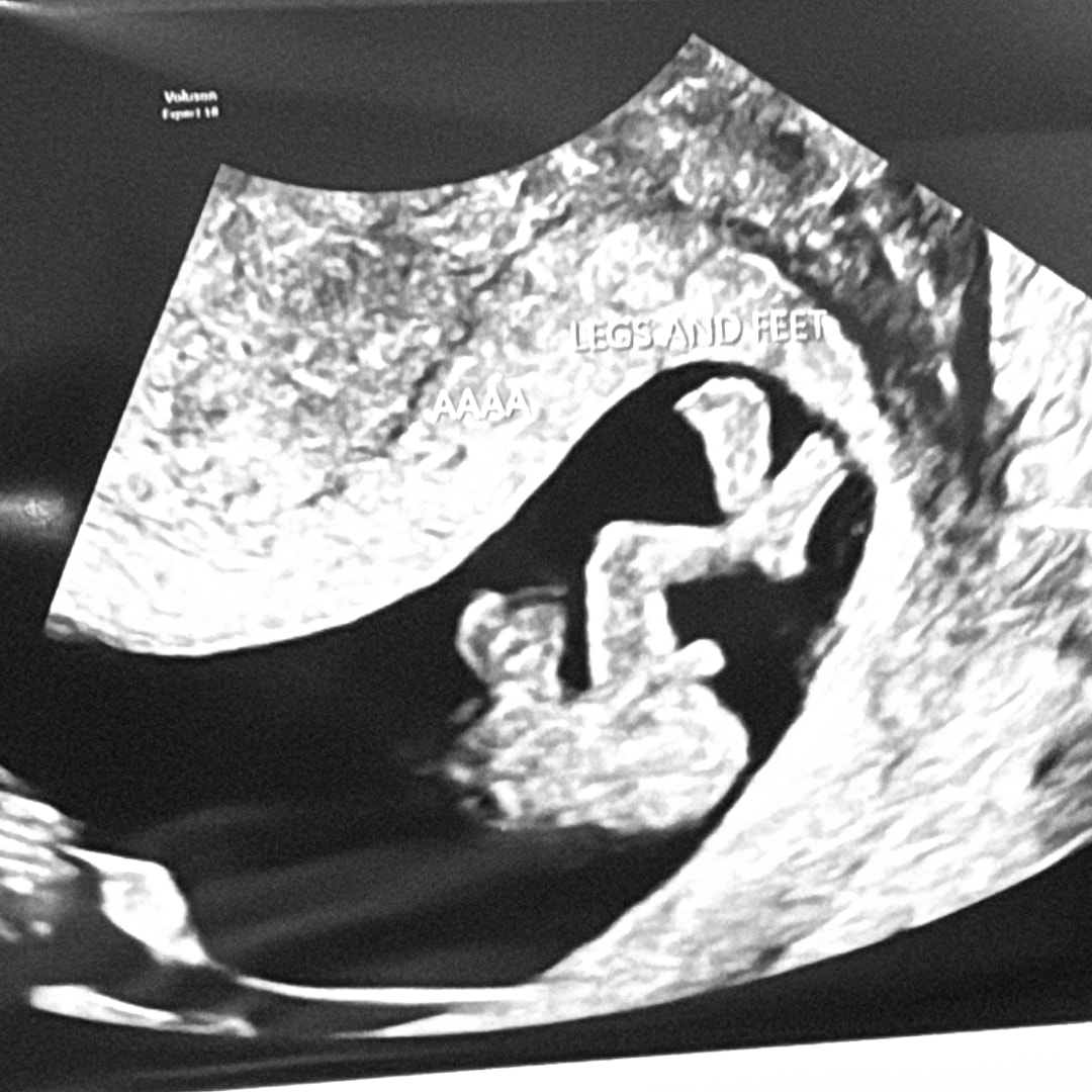 Photo shared by Bano for their Babylist baby registry.