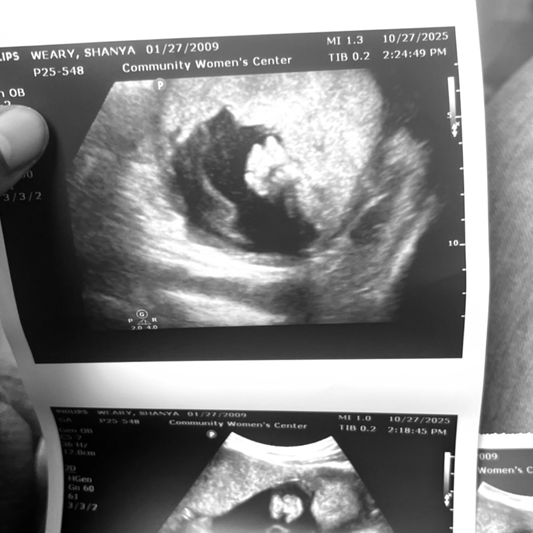 Photo shared by Shanya for their Babylist baby registry.