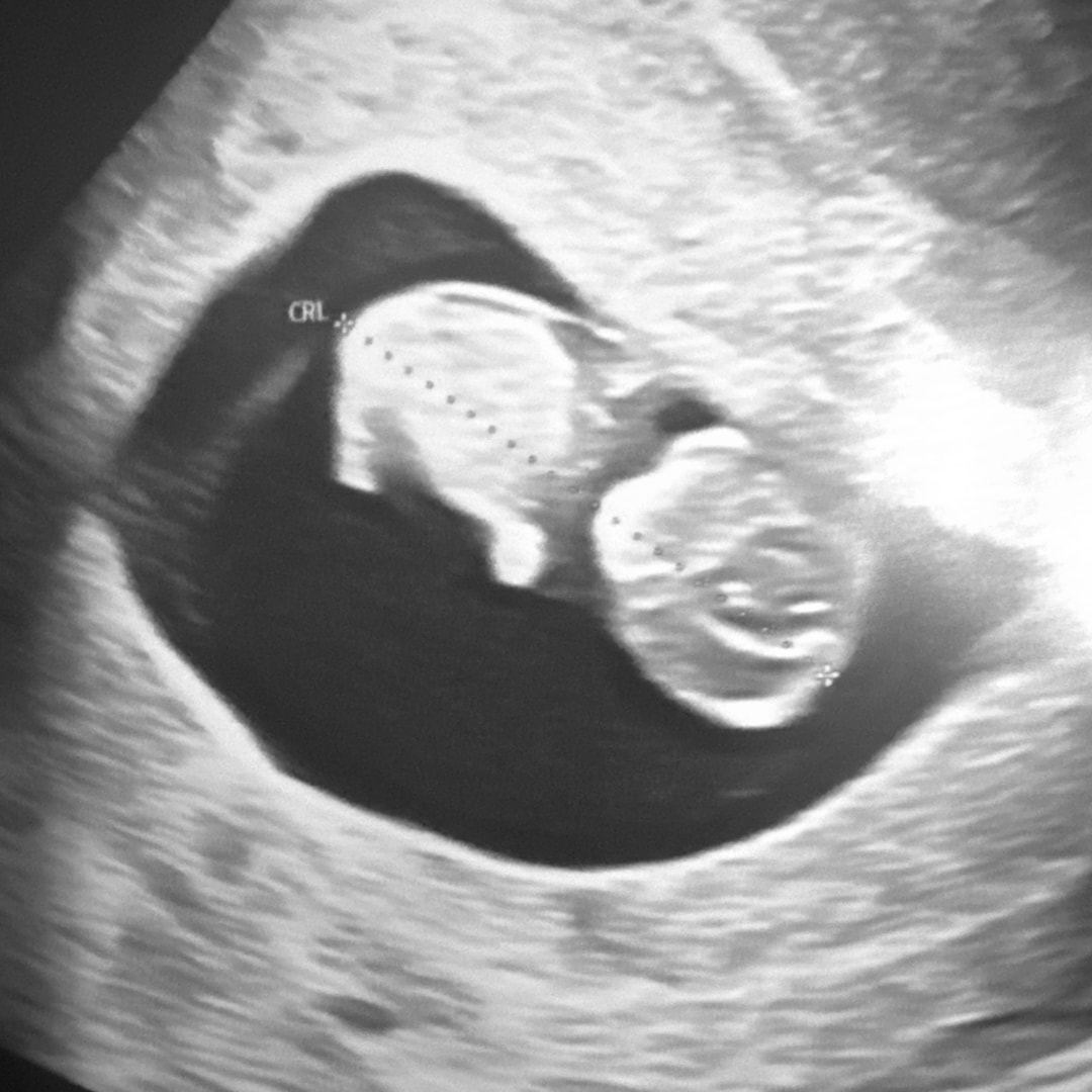 Photo shared by Myah for their Babylist baby registry.