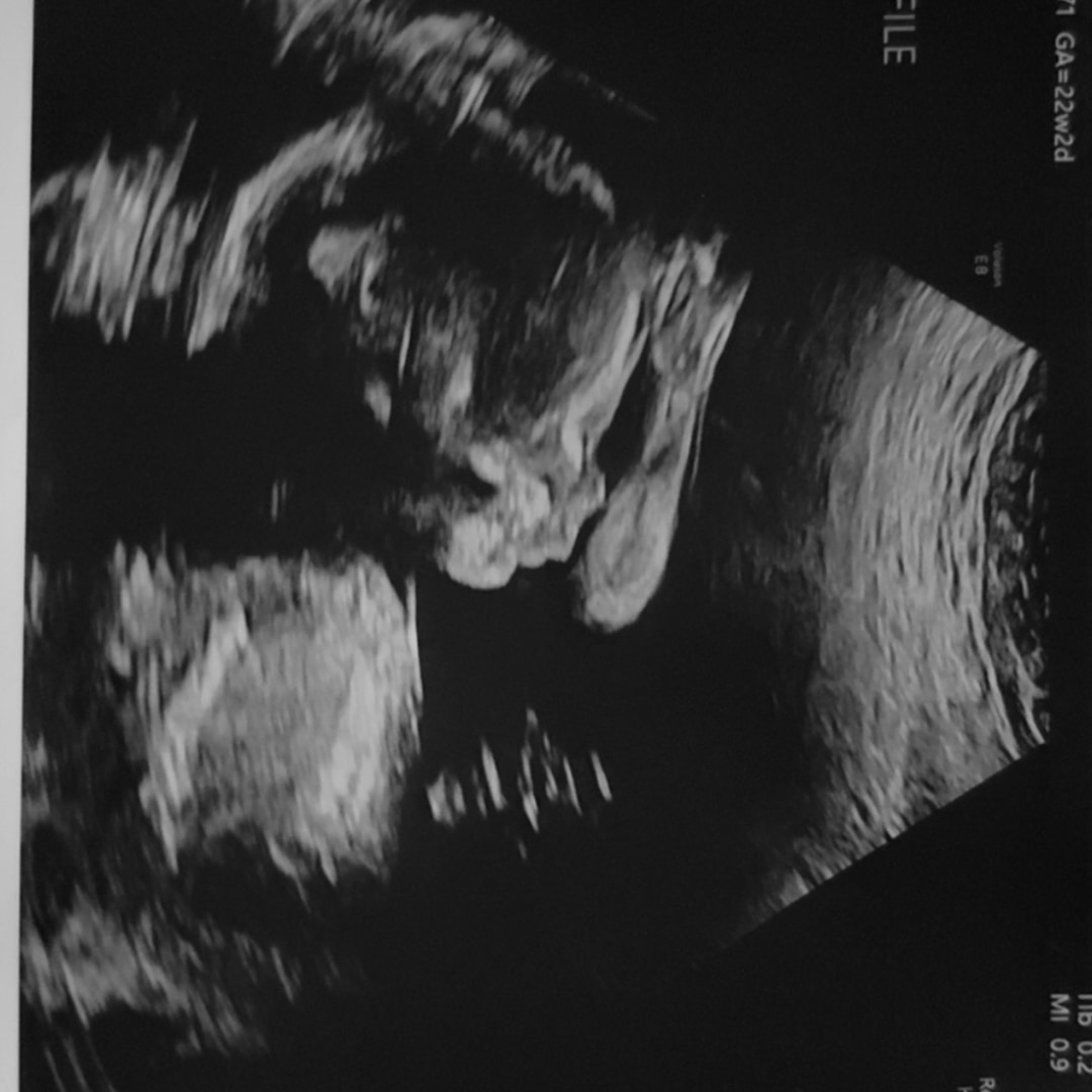 Photo shared by Breanne for their Babylist baby registry.