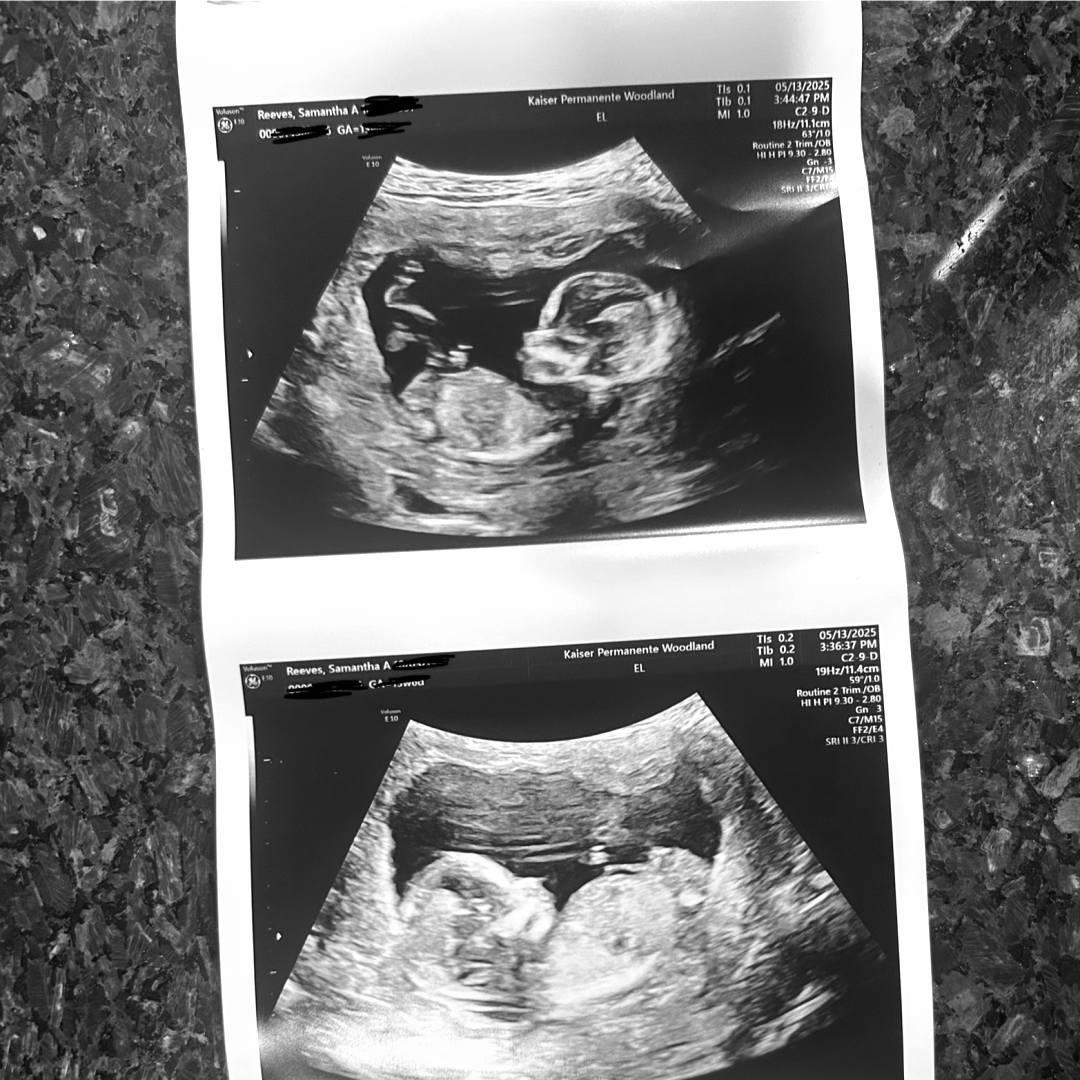 Photo shared by Samantha for their Babylist baby registry.
