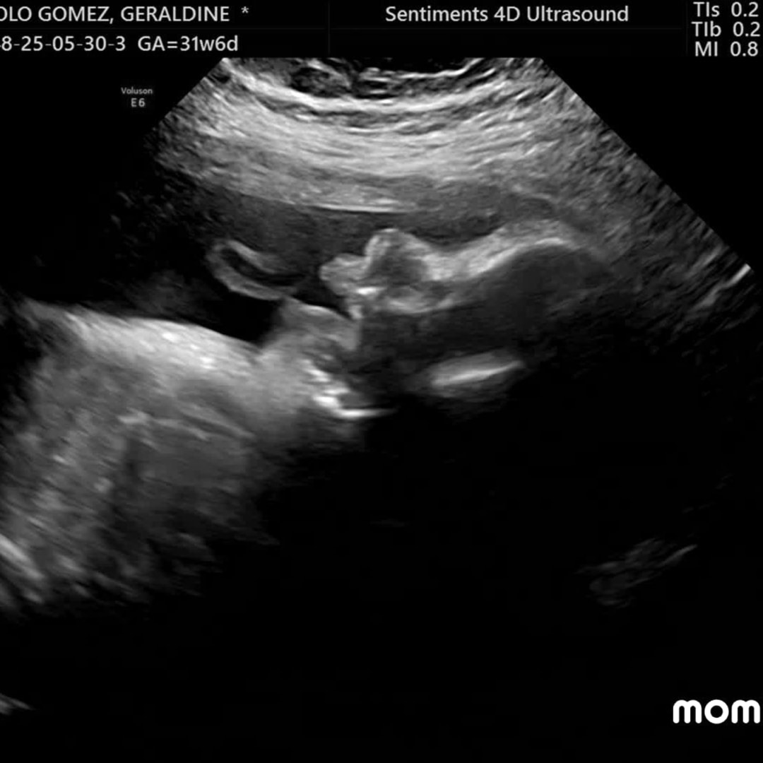 Photo shared by Geraldine for their Babylist baby registry.