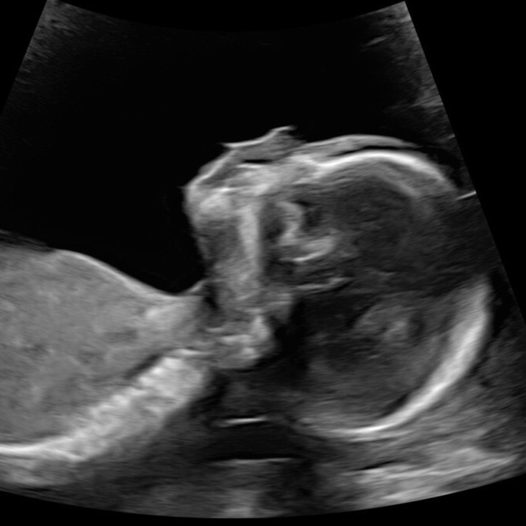 Photo shared by Alison for their Babylist baby registry.