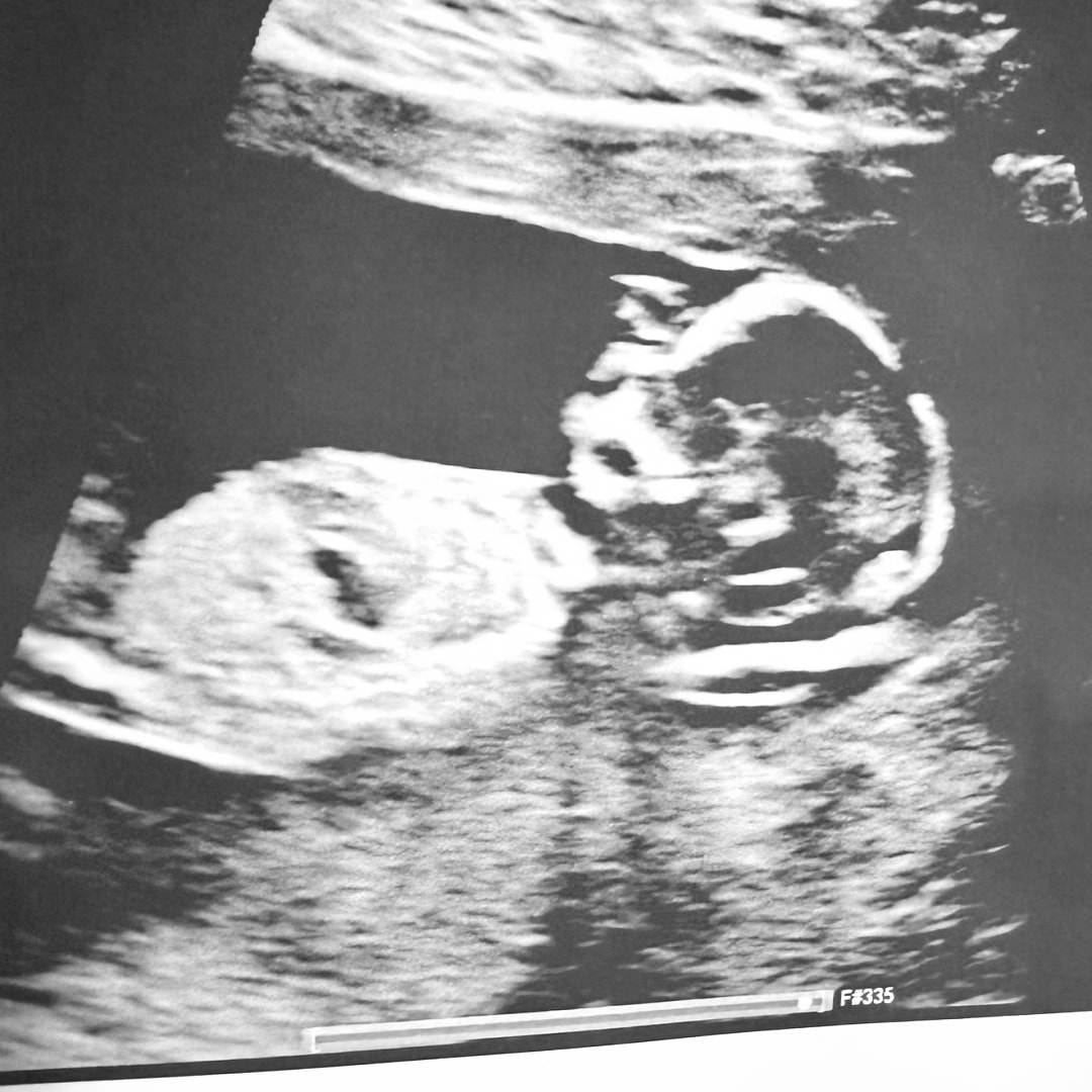 Photo shared by Erin for their Babylist baby registry.