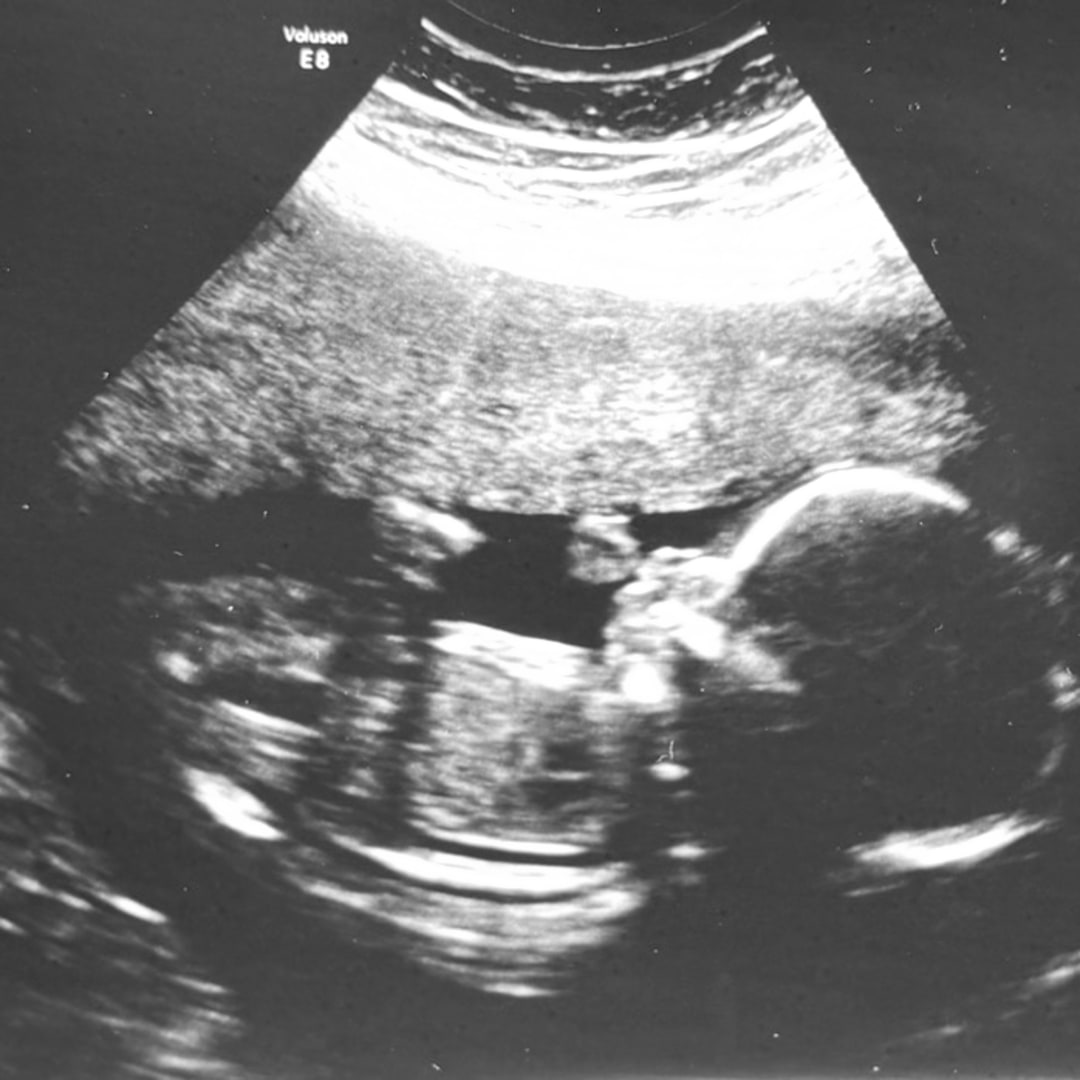 Photo shared by Isabel for their Babylist baby registry.