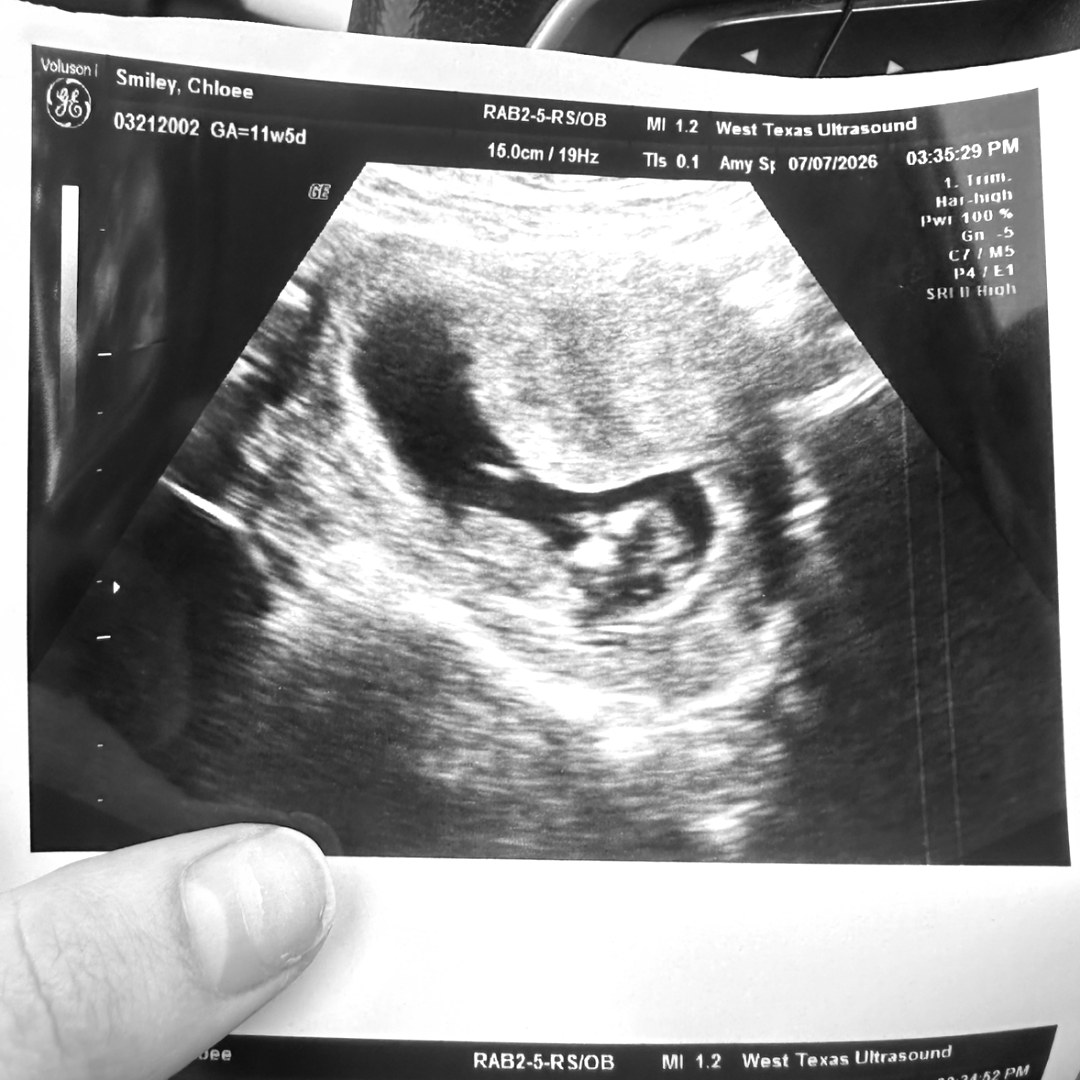 Photo shared by Chloee for their Babylist baby registry.