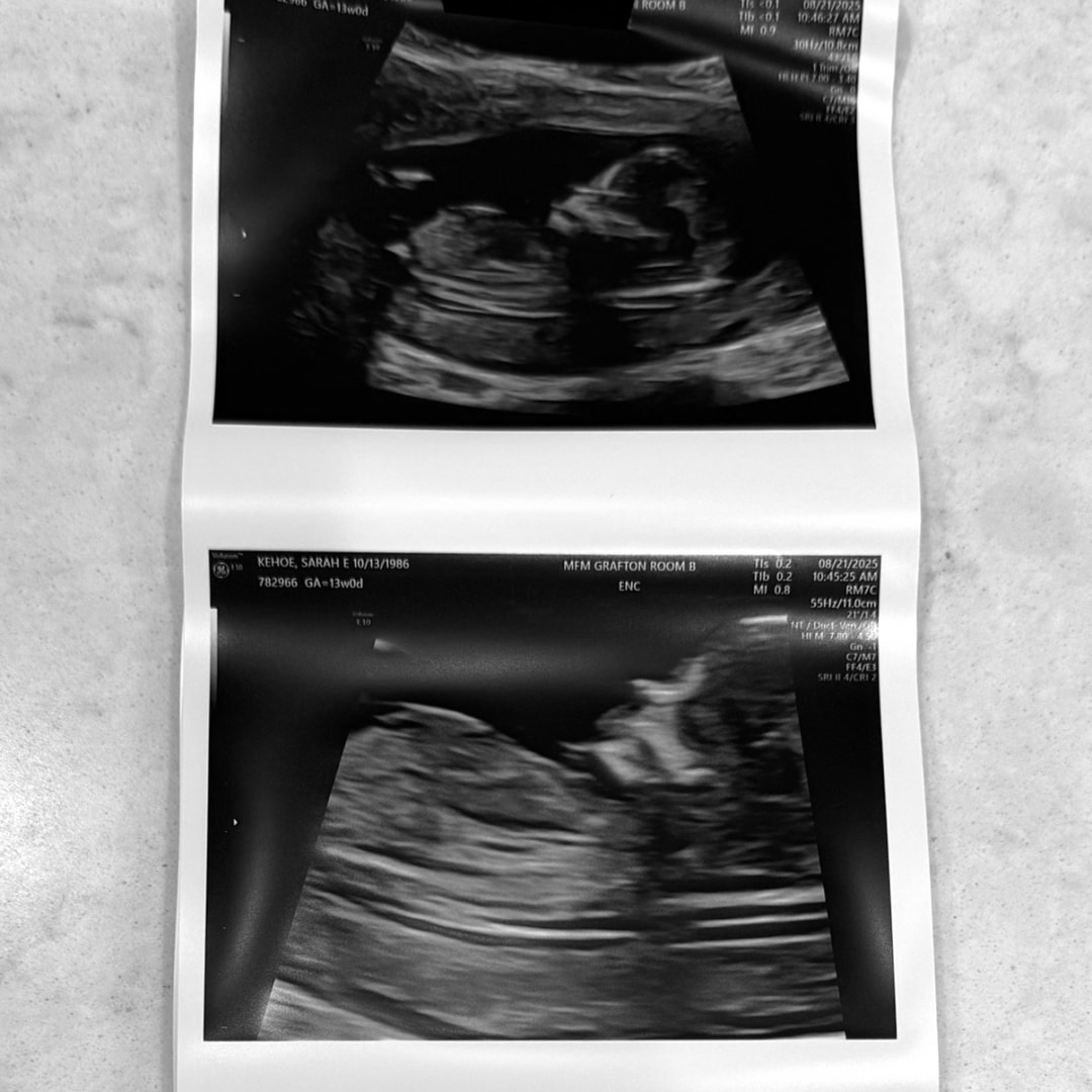 Photo shared by Sarah for their Babylist baby registry.