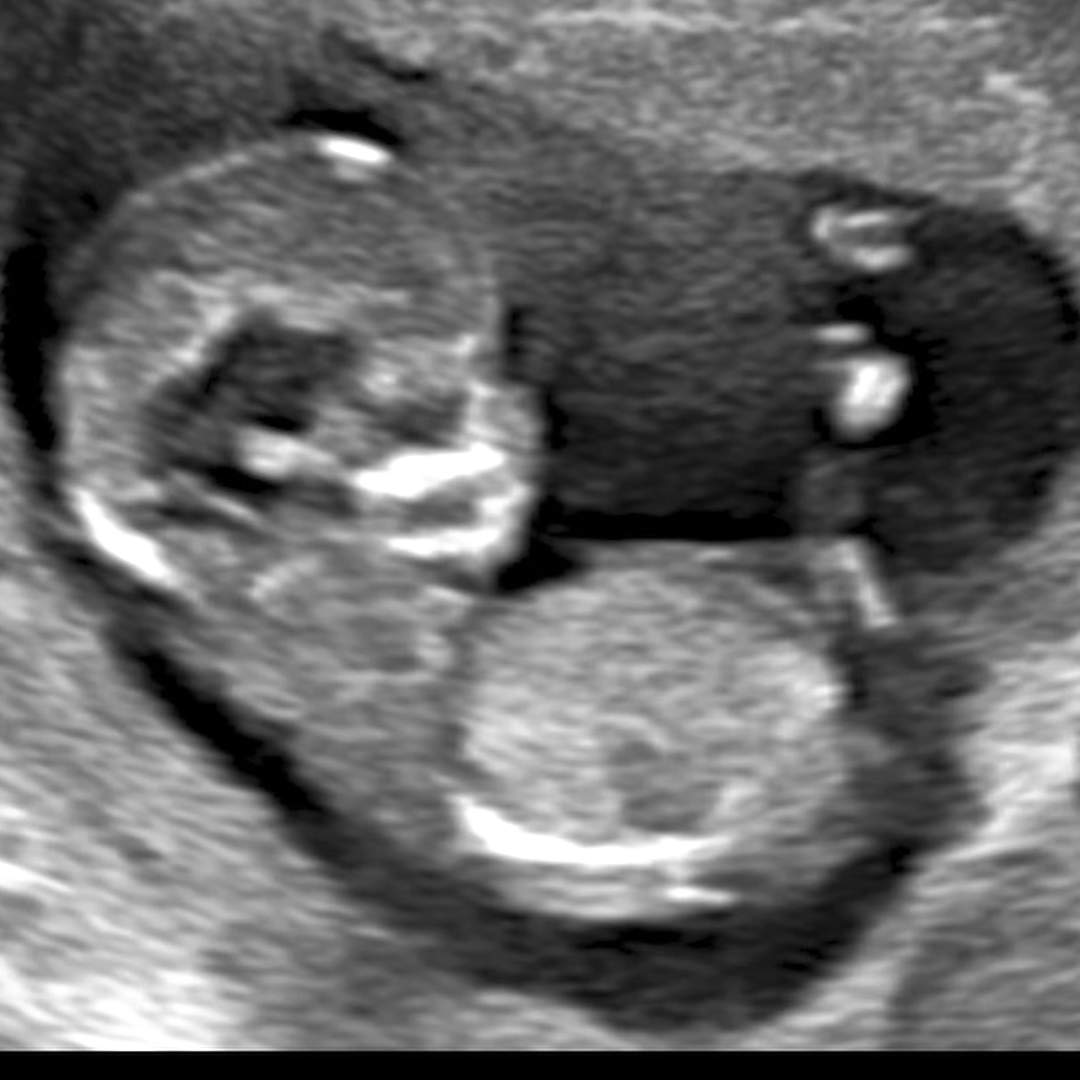 Photo shared by Kayla for their Babylist baby registry.