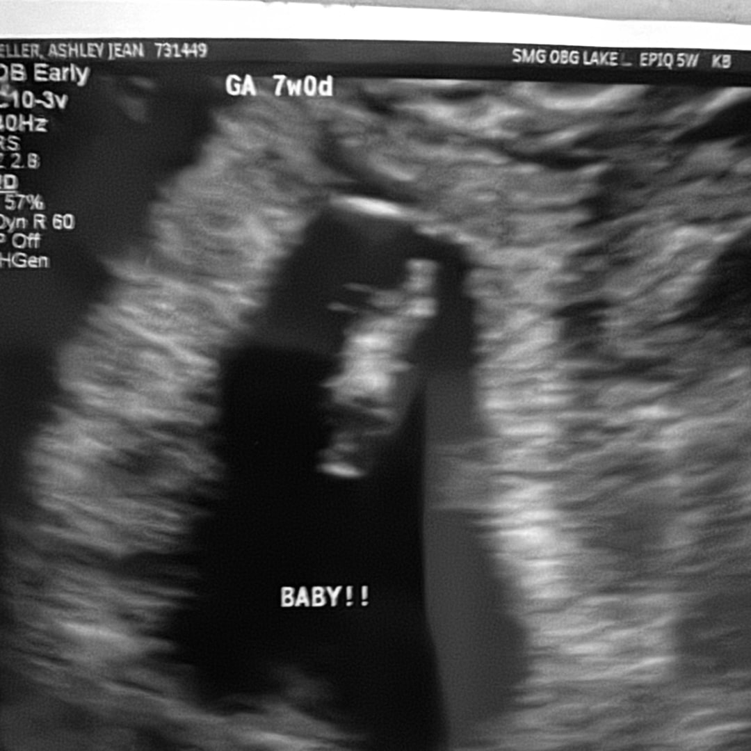 Photo shared by Ashley for their Babylist baby registry.
