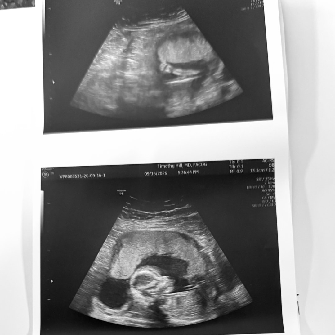 Photo shared by Abbygale for their Babylist baby registry.
