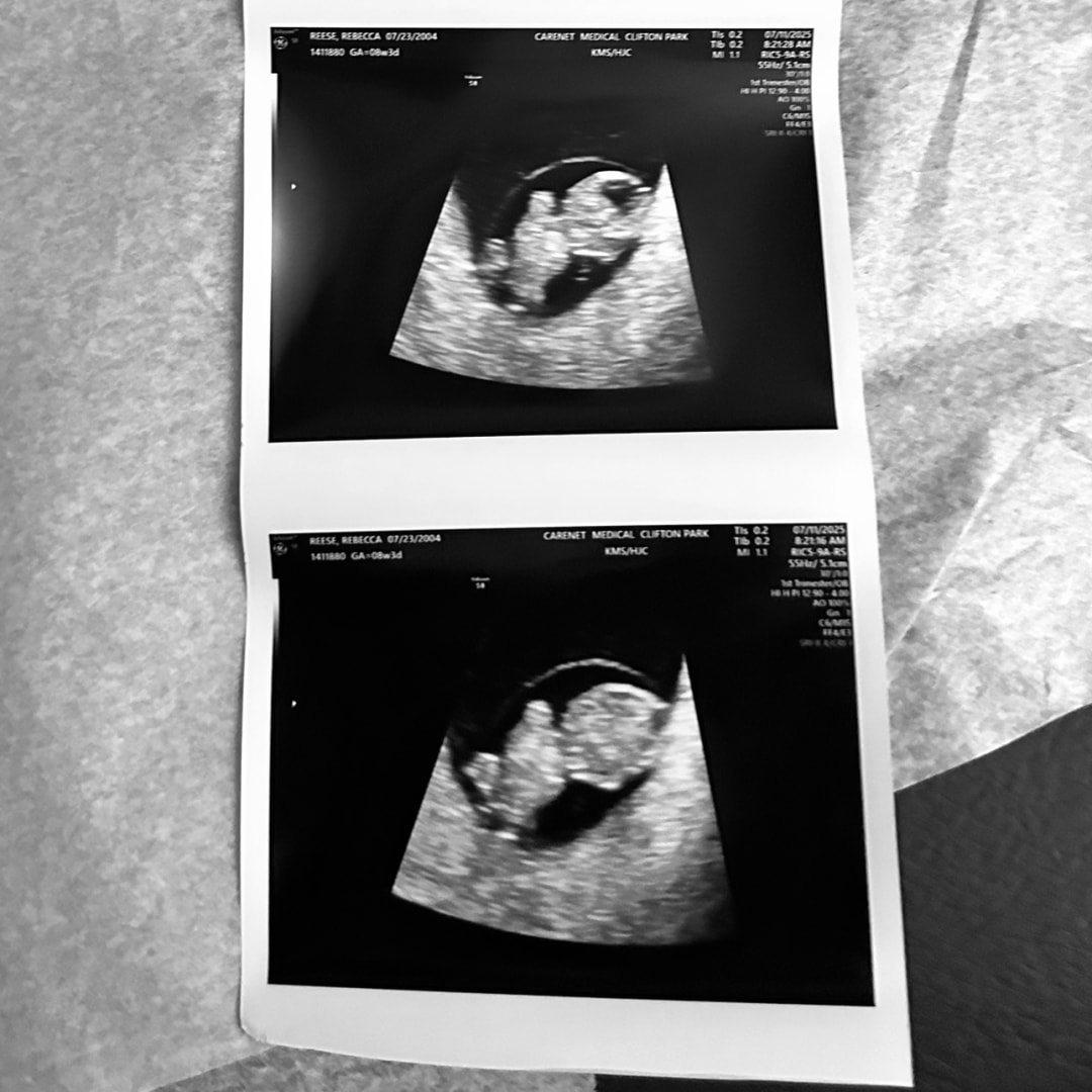 Photo shared by Rebecca for their Babylist baby registry.