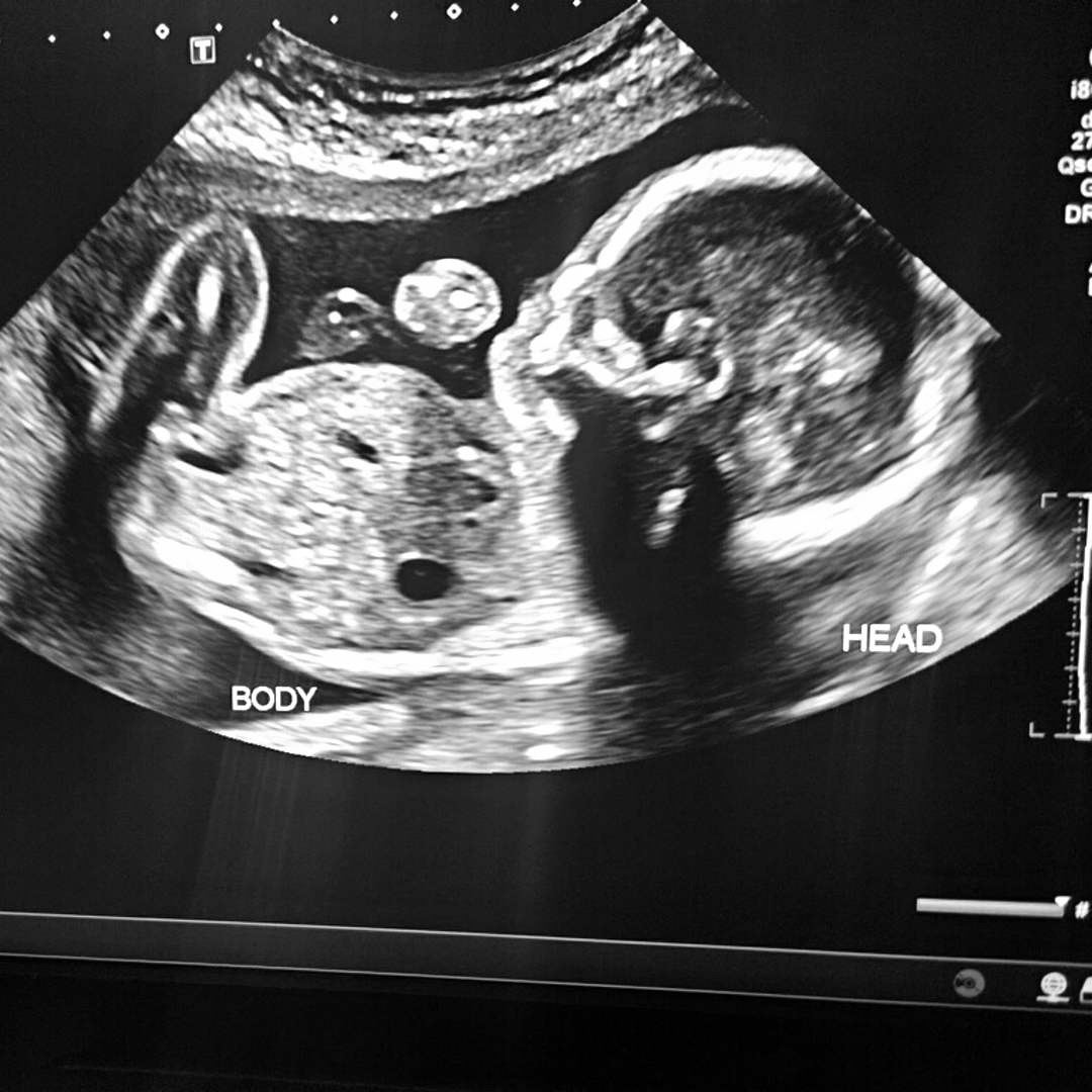 Photo shared by Erika for their Babylist baby registry.