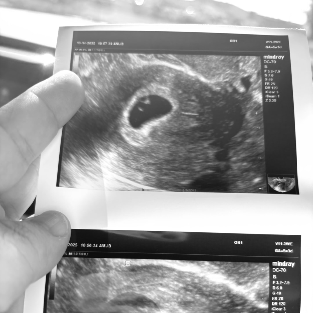 Photo shared by Tiffany for their Babylist baby registry.