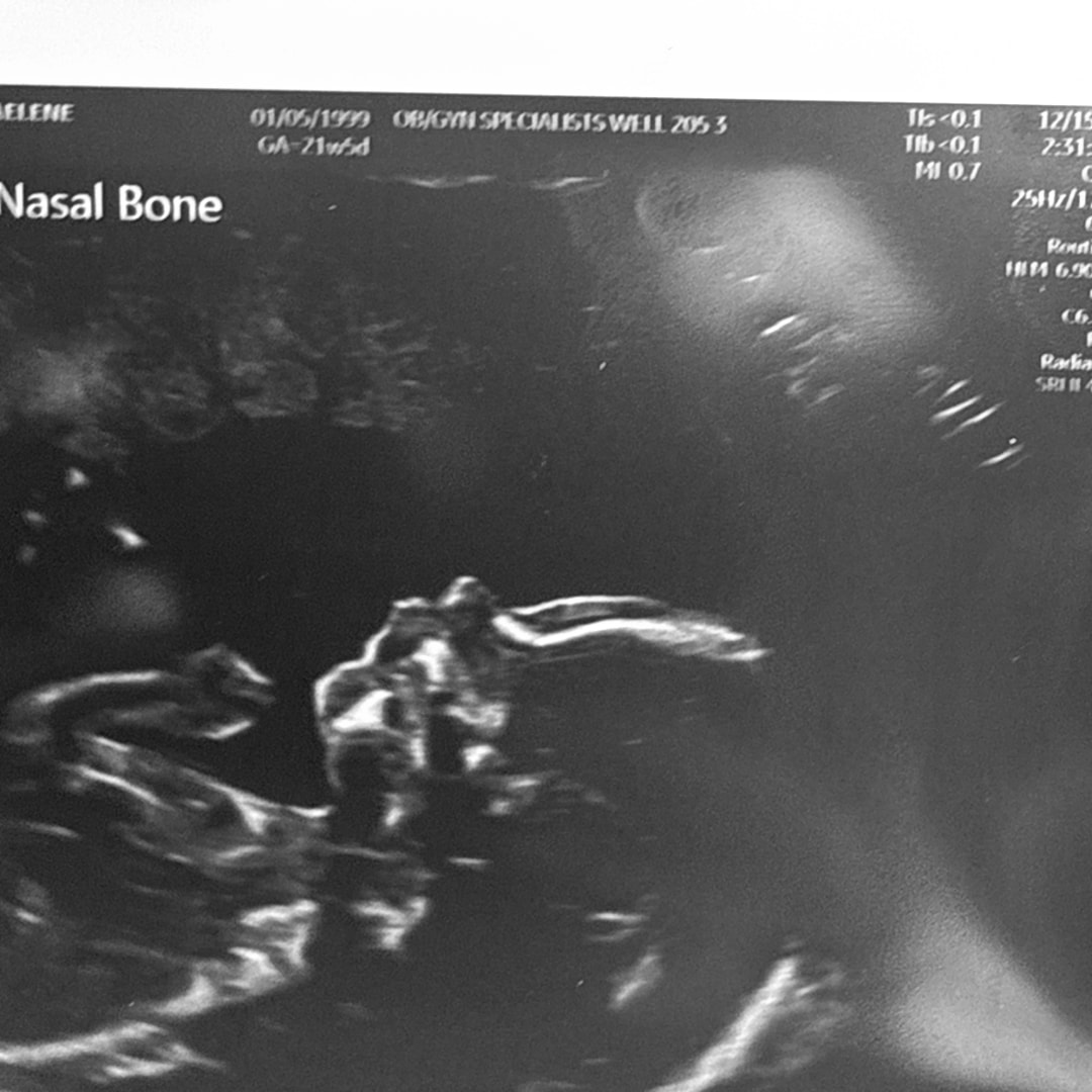 Photo shared by Michaelene for their Babylist baby registry.