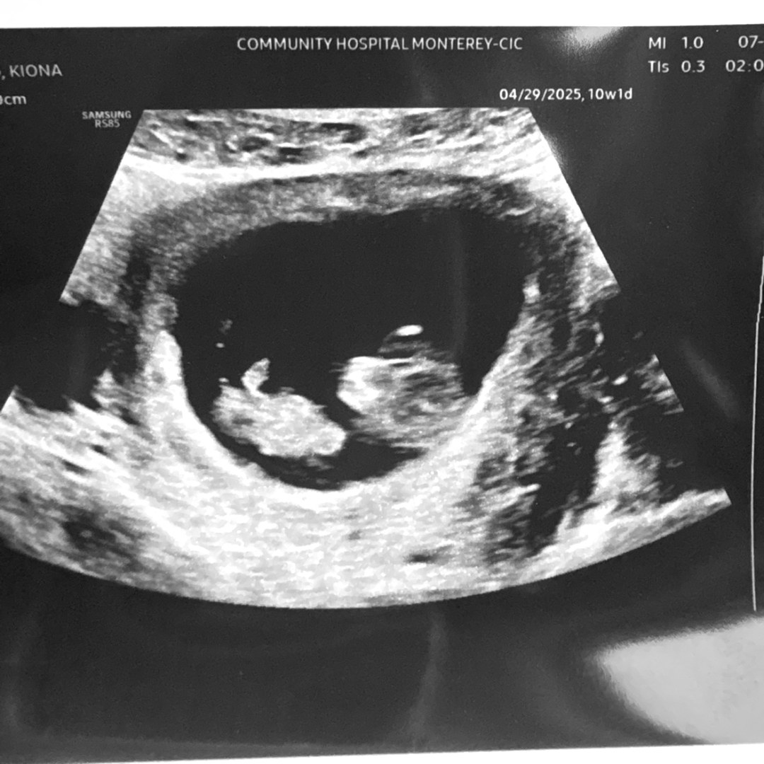 Photo shared by Kiona for their Babylist baby registry.