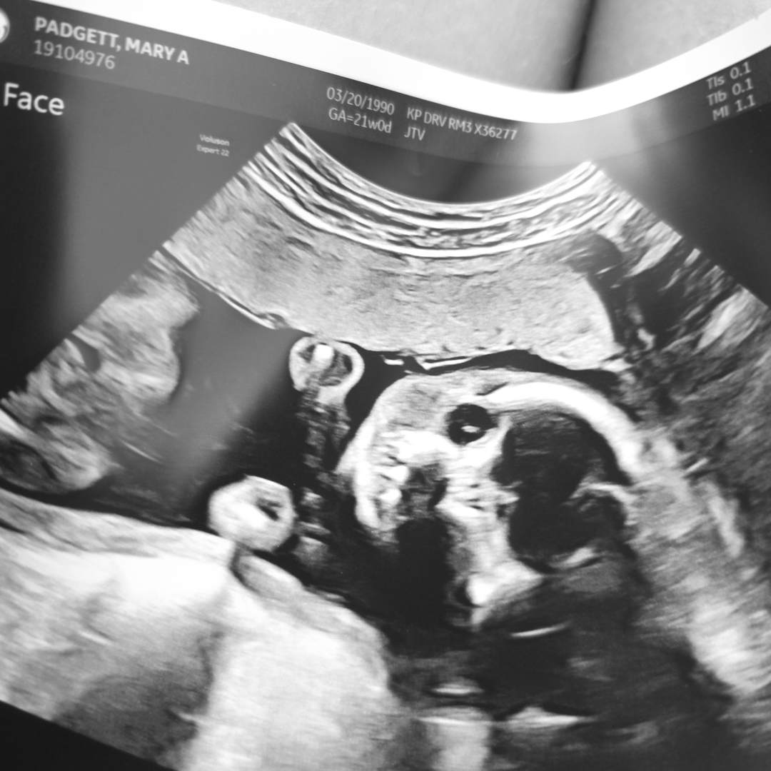 Photo shared by Arlayna for their Babylist baby registry.