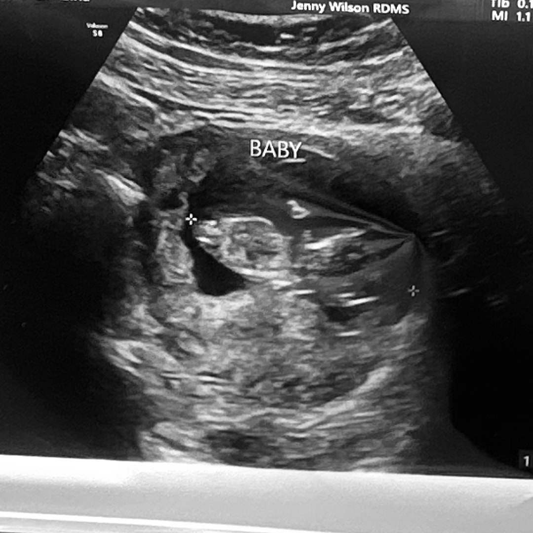 Photo shared by Abigail for their Babylist baby registry.