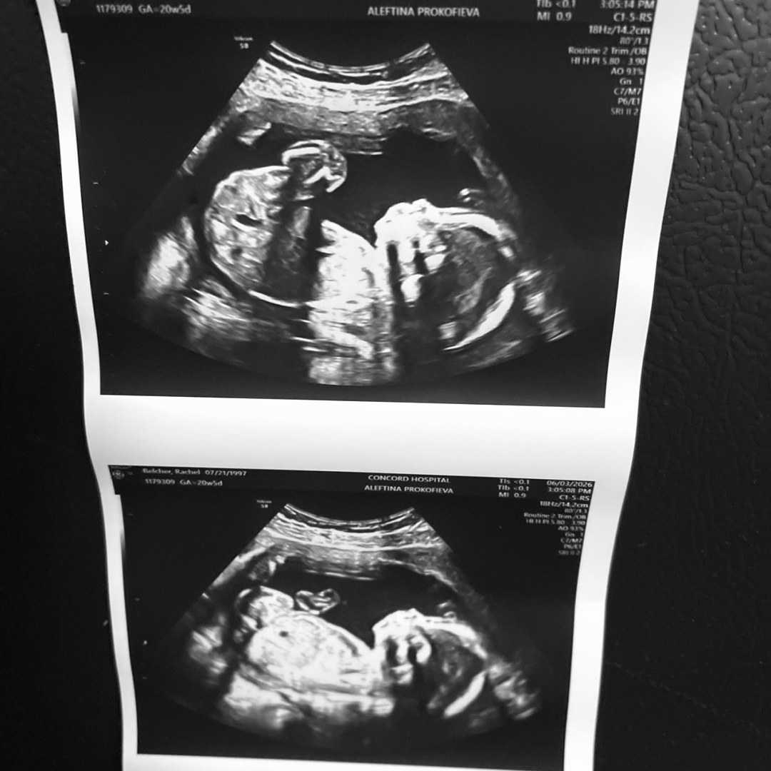Photo shared by Rachel for their Babylist baby registry.