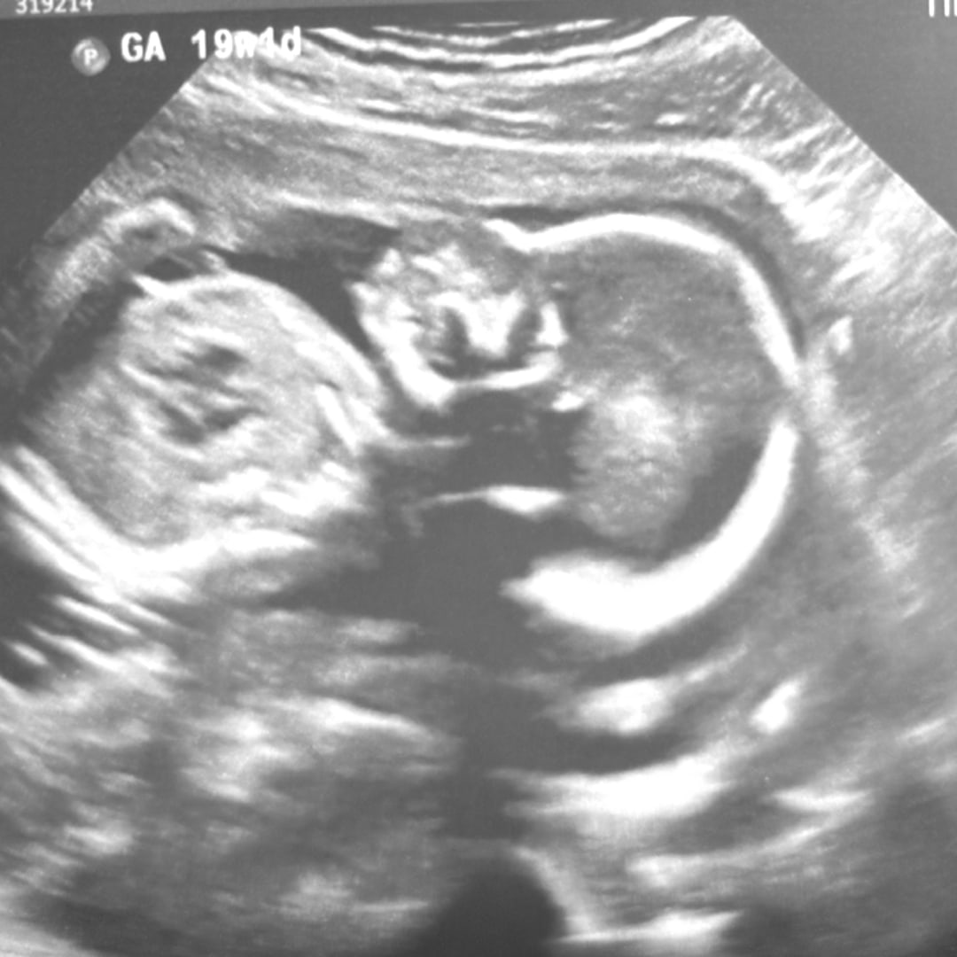 Photo shared by Jess for their Babylist baby registry.