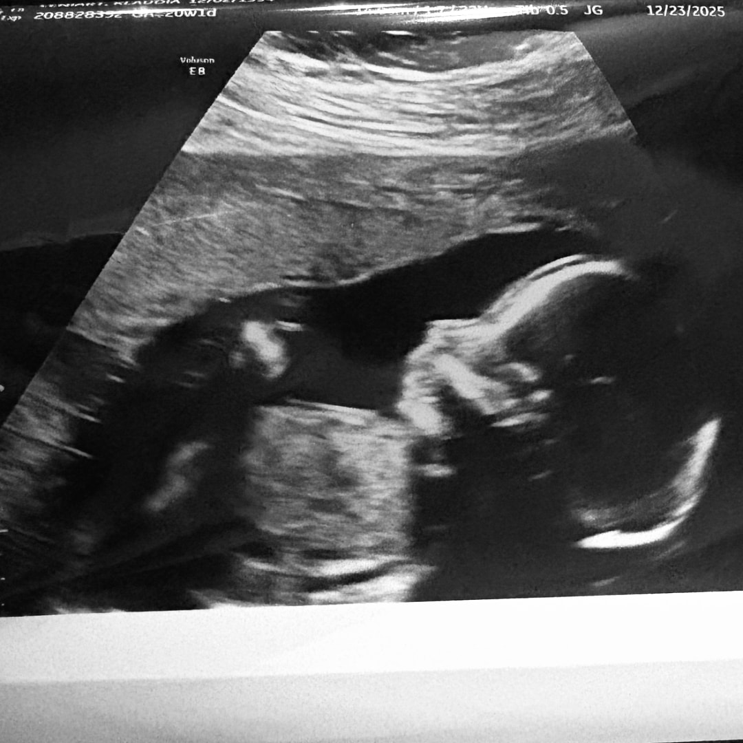 Photo shared by Klaudia for their Babylist baby registry.