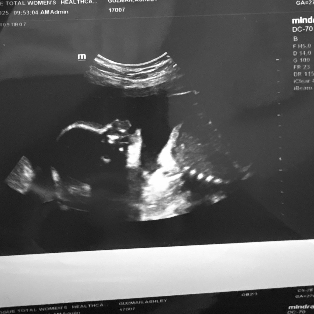 Photo shared by Ashley for their Babylist baby registry.