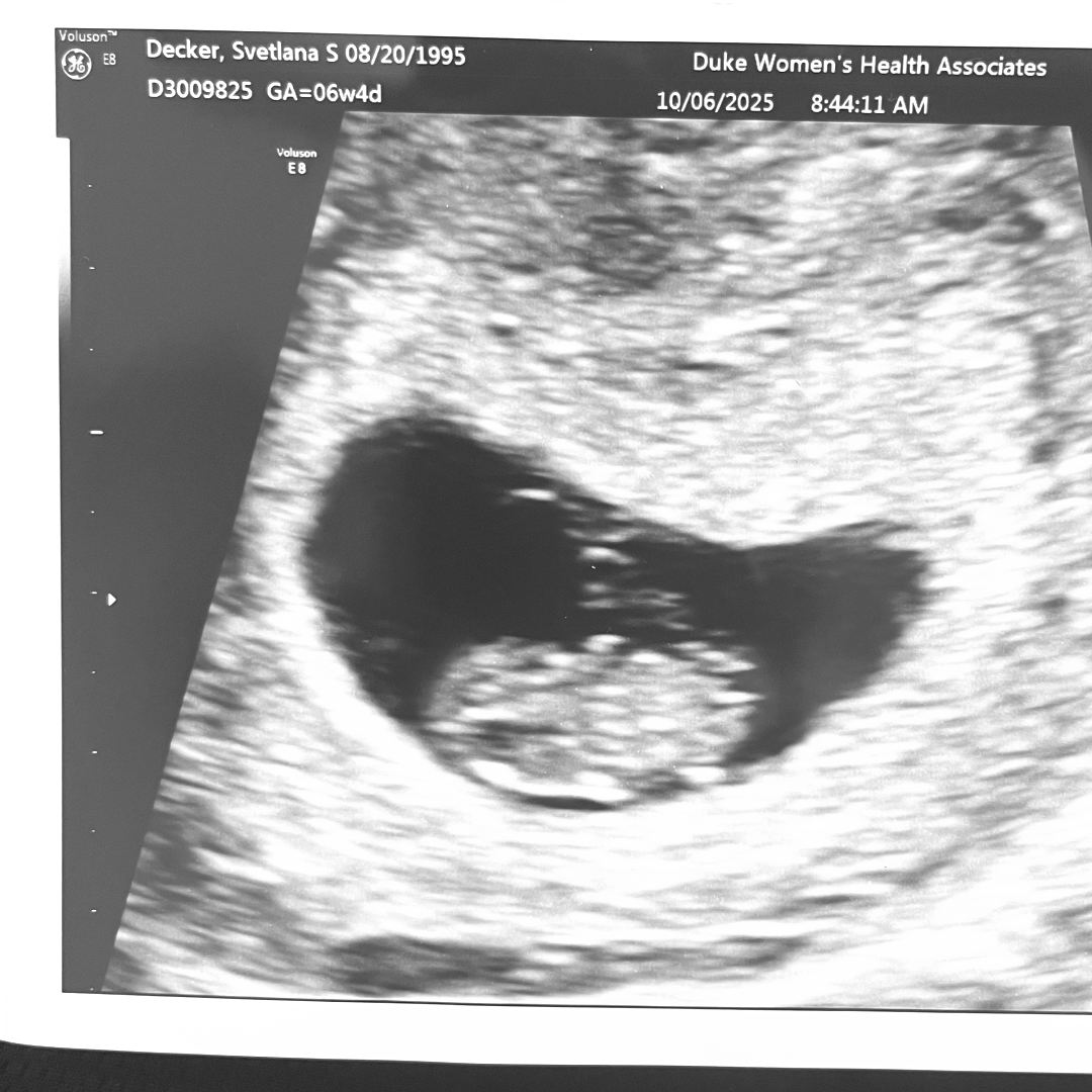 Photo shared by Kelsie for their Babylist baby registry.