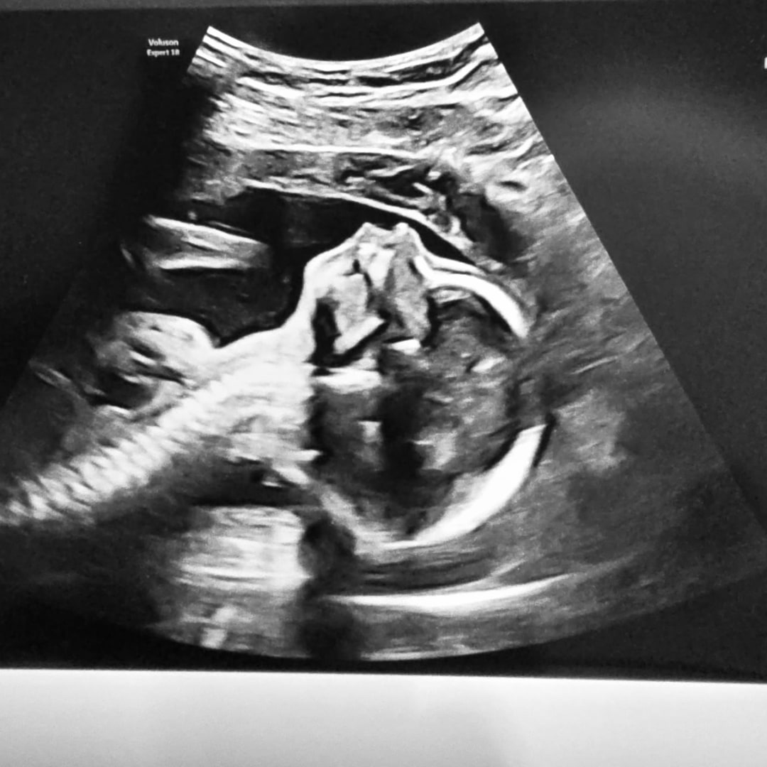 Photo shared by Bryan for their Babylist baby registry.