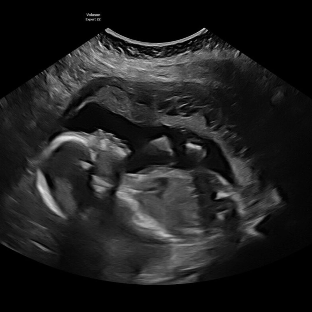 Photo shared by Lexi for their Babylist baby registry.