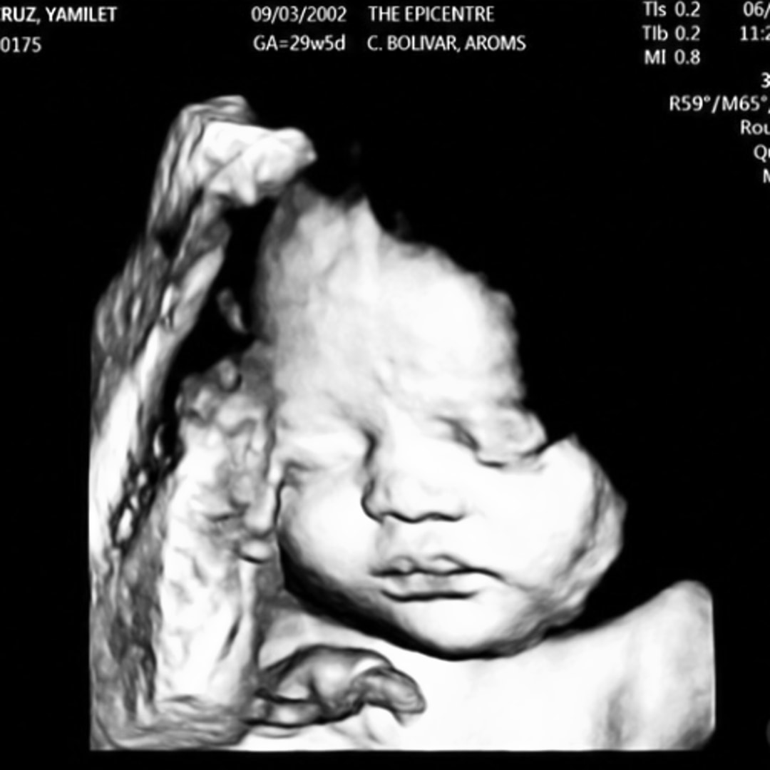 Photo shared by Yamilet for their Babylist baby registry.