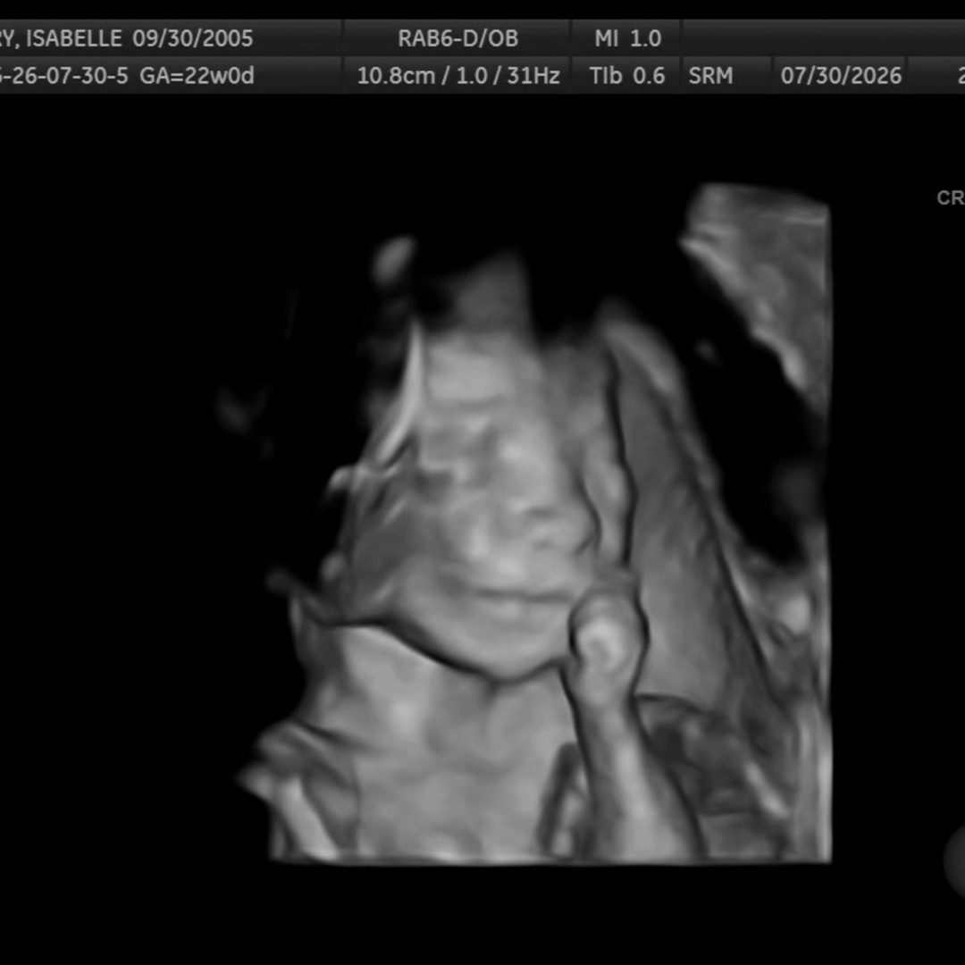 Photo shared by Isabelle for their Babylist baby registry.