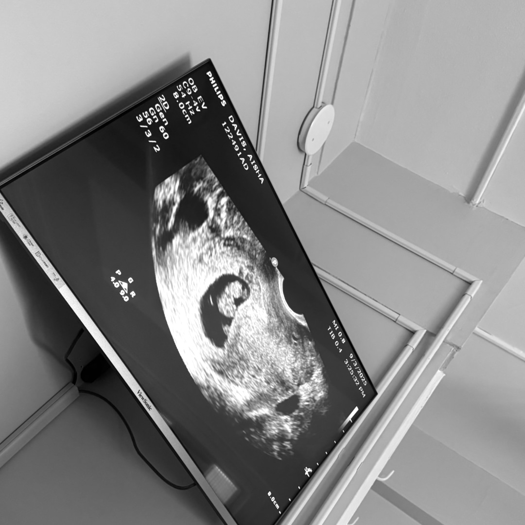 Photo shared by Aisha for their Babylist baby registry.