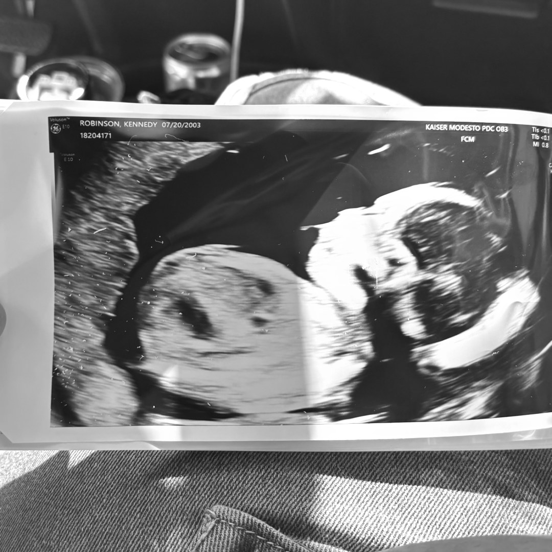 Photo shared by Kennedy for their Babylist baby registry.