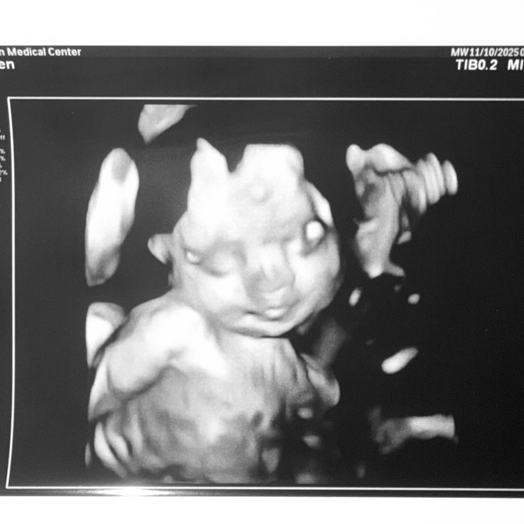 Photo shared by Katlyn for their Babylist baby registry.