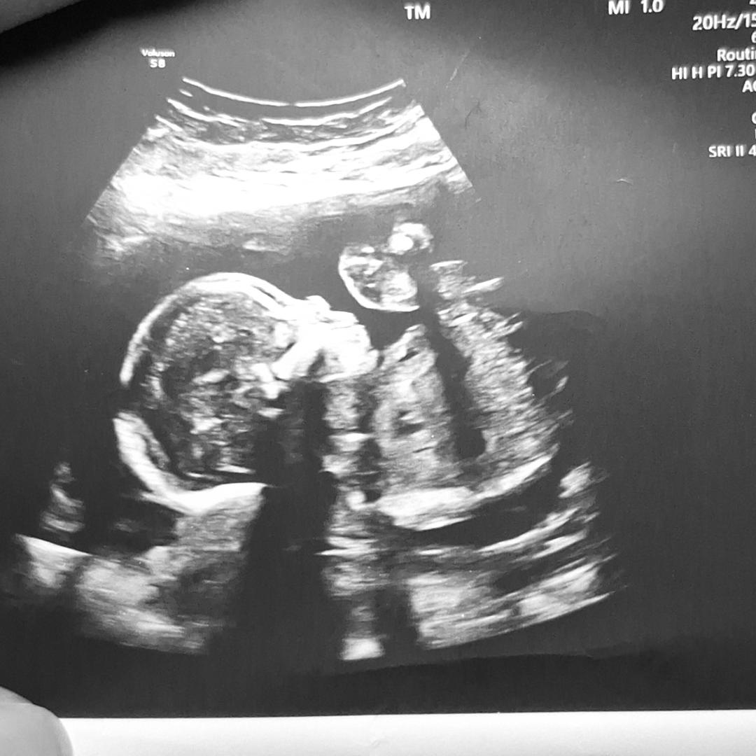 Photo shared by Byanca for their Babylist baby registry.