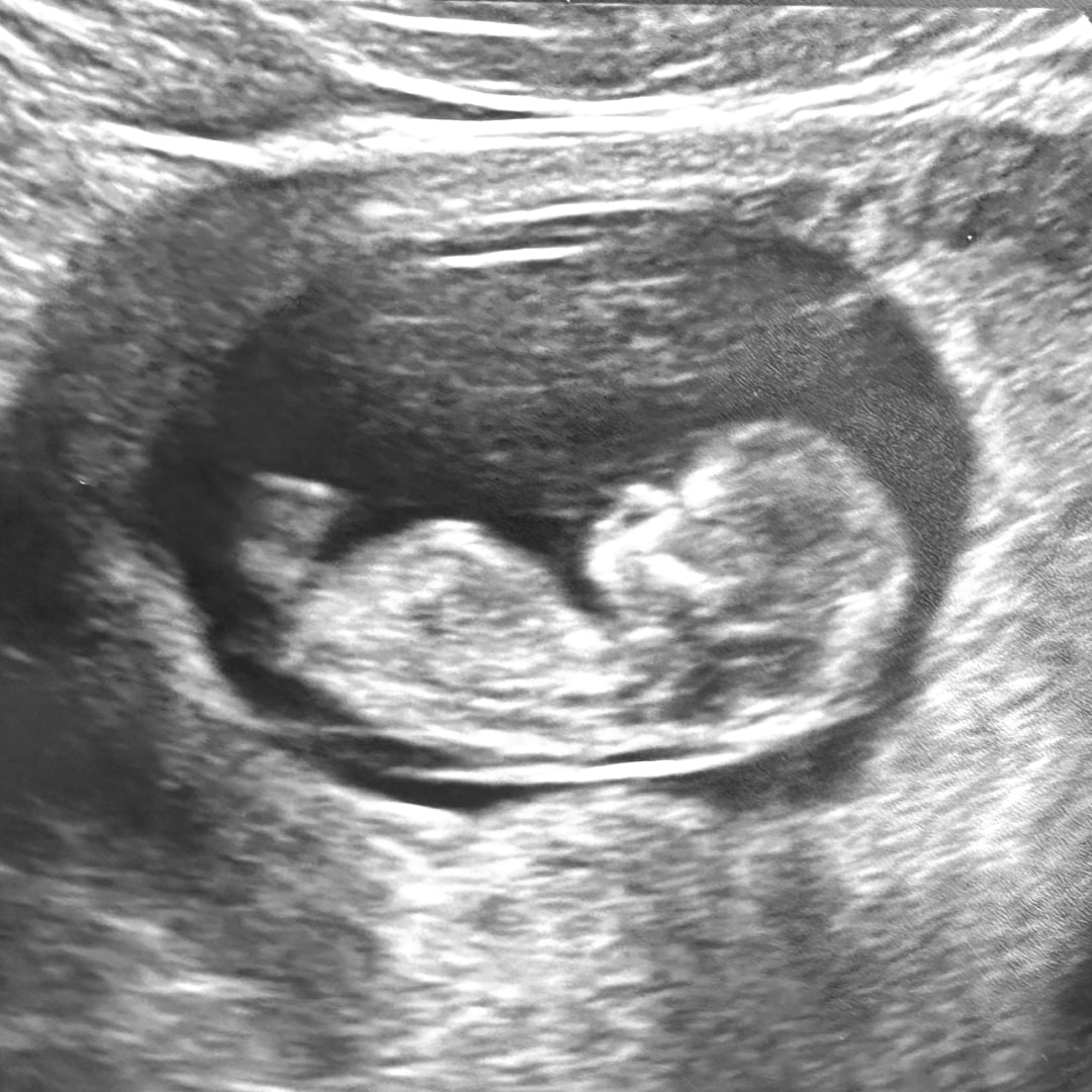 Photo shared by Trinity for their Babylist baby registry.