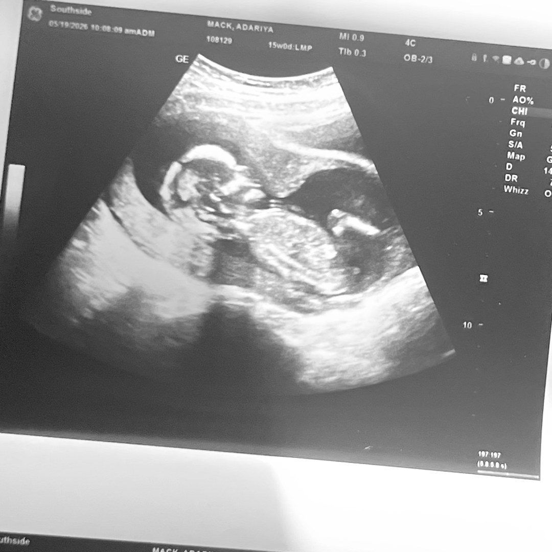Photo shared by Adariya for their Babylist baby registry.