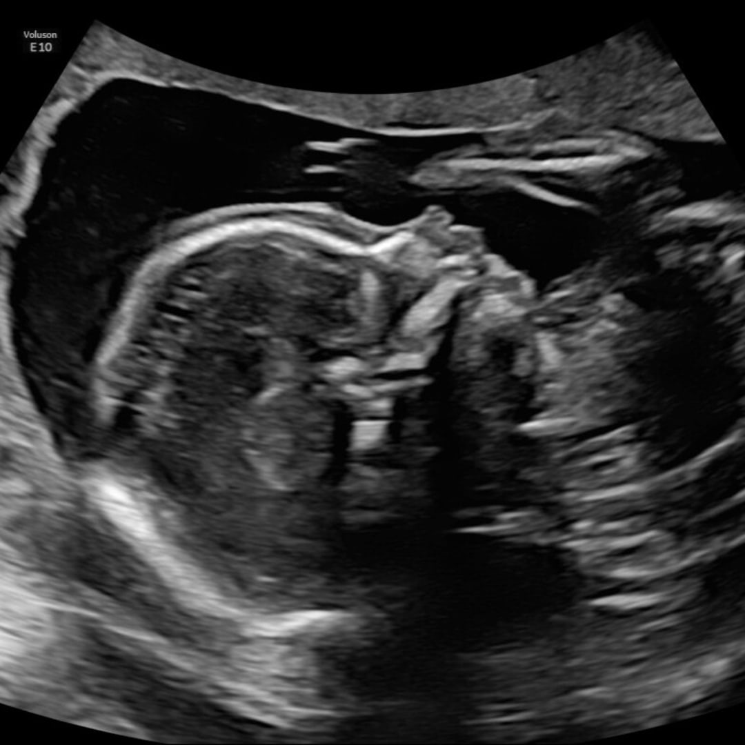 Photo shared by Kayla for their Babylist baby registry.