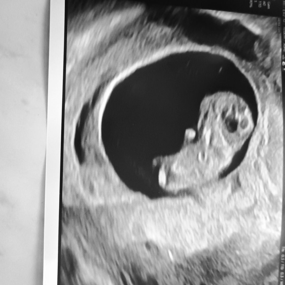 Photo shared by Casey for their Babylist baby registry.