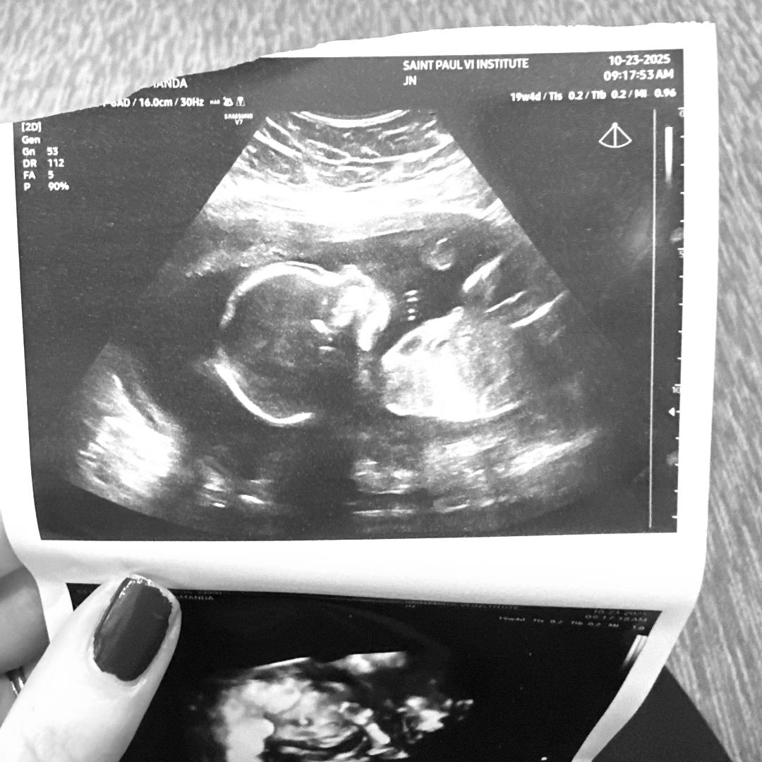 Photo shared by Mandy for their Babylist baby registry.