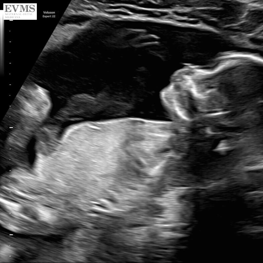 Photo shared by Candice for their Babylist baby registry.