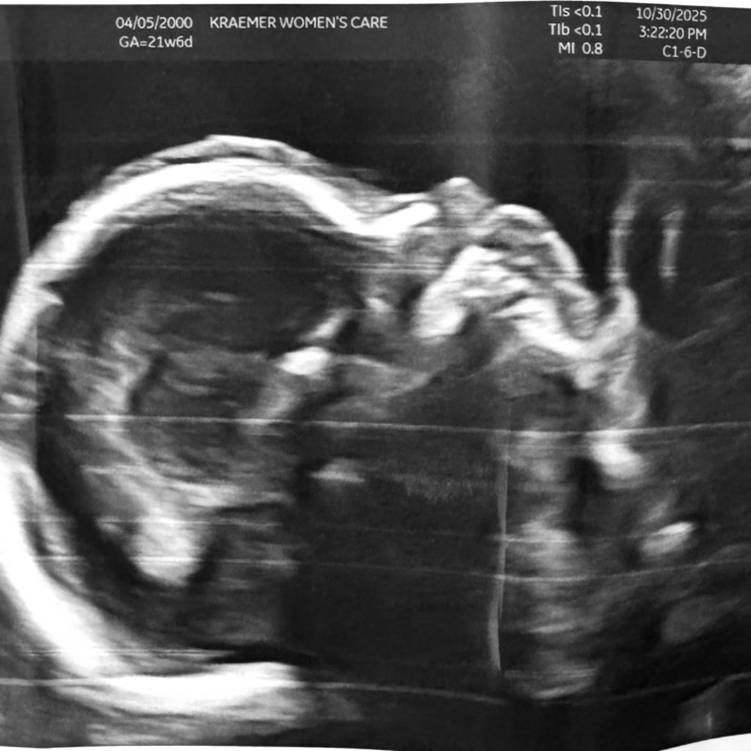 Photo shared by Kylie for their Babylist baby registry.