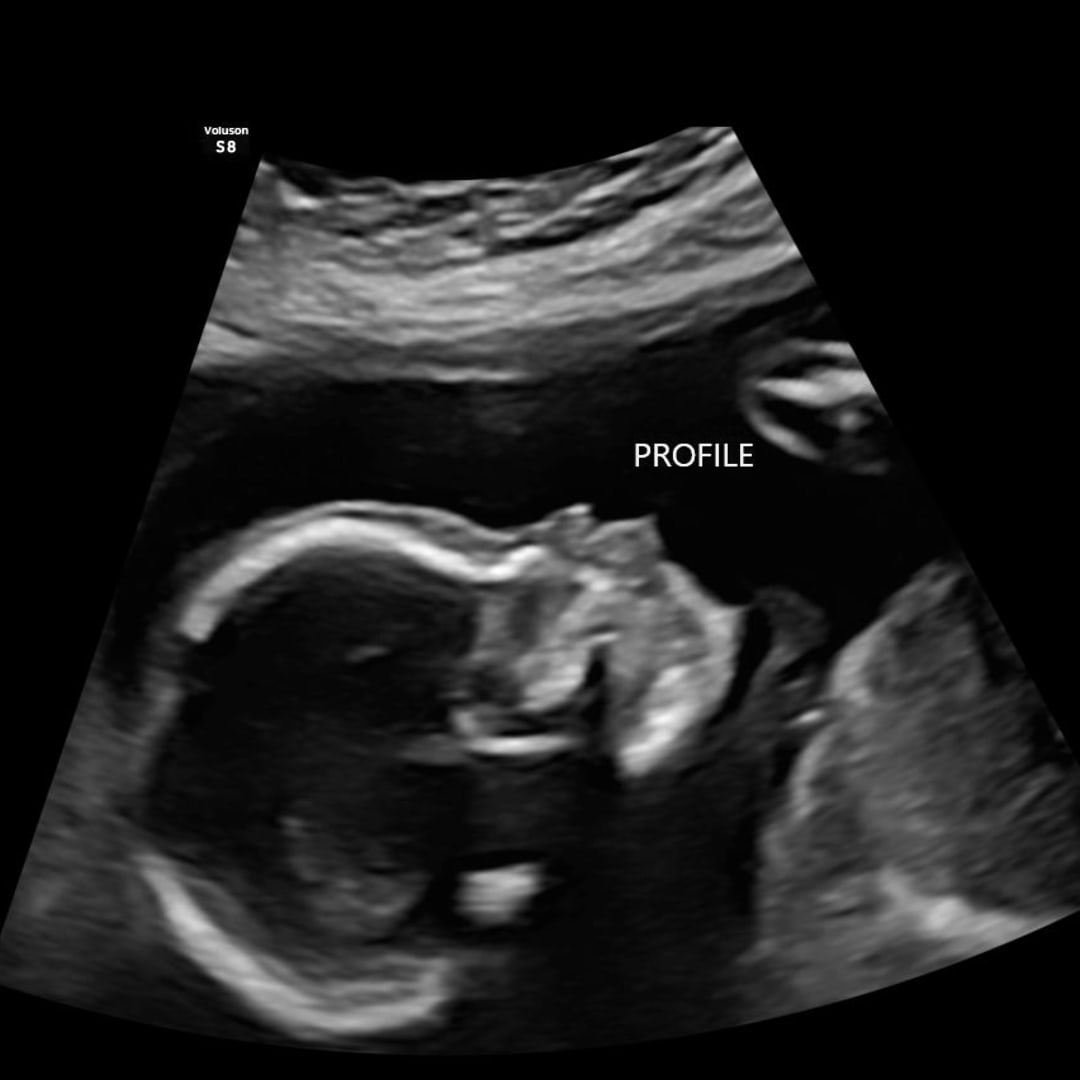 Photo shared by Josseth for their Babylist baby registry.
