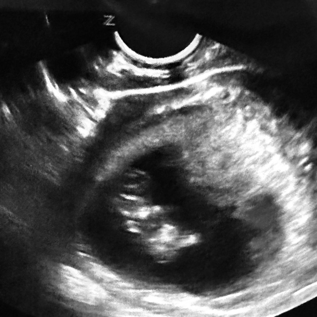 Photo shared by Citlali for their Babylist baby registry.