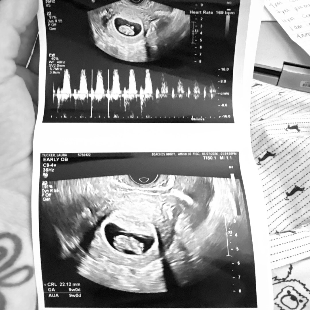 Photo shared by Laura for their Babylist baby registry.