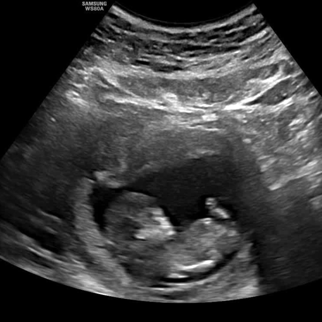 Photo shared by Claudia for their Babylist baby registry.